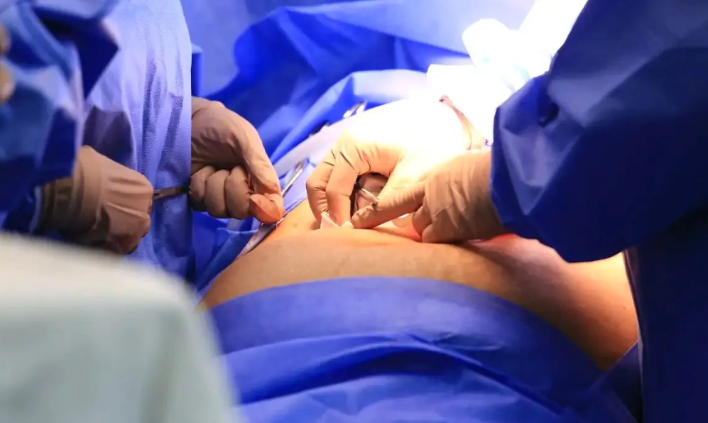 Tocantins está entre os cinco estados que podem zerar fila de cirurgias no SUS, afirma MS