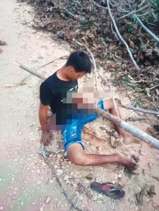 Jovem que teve tronco atravessado no peito em acidente de moto morre após ficar mais de 20 dias internado